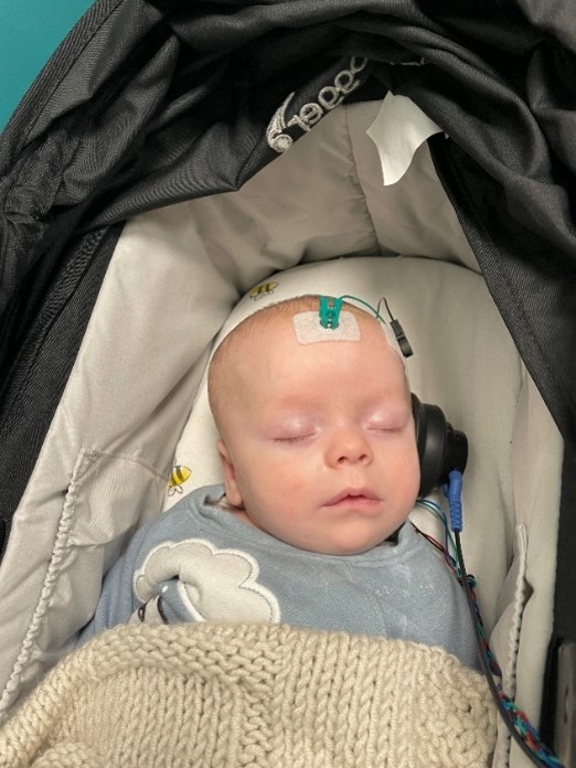 Sleeping infant in a stroller with scalp electrodes and wires, wearing a blue onesie and a beige knitted blanket.